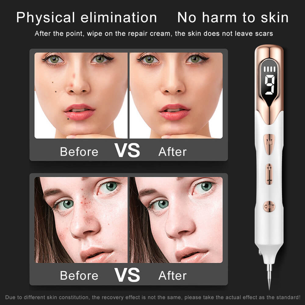 Ansiktsvårdsenheter Electric Plasma Mole Removal Pen Laser Set Wart Remover Skin Pore Corn Freckle Dark Tag Nevus Pimple Spot Tattoo1179505