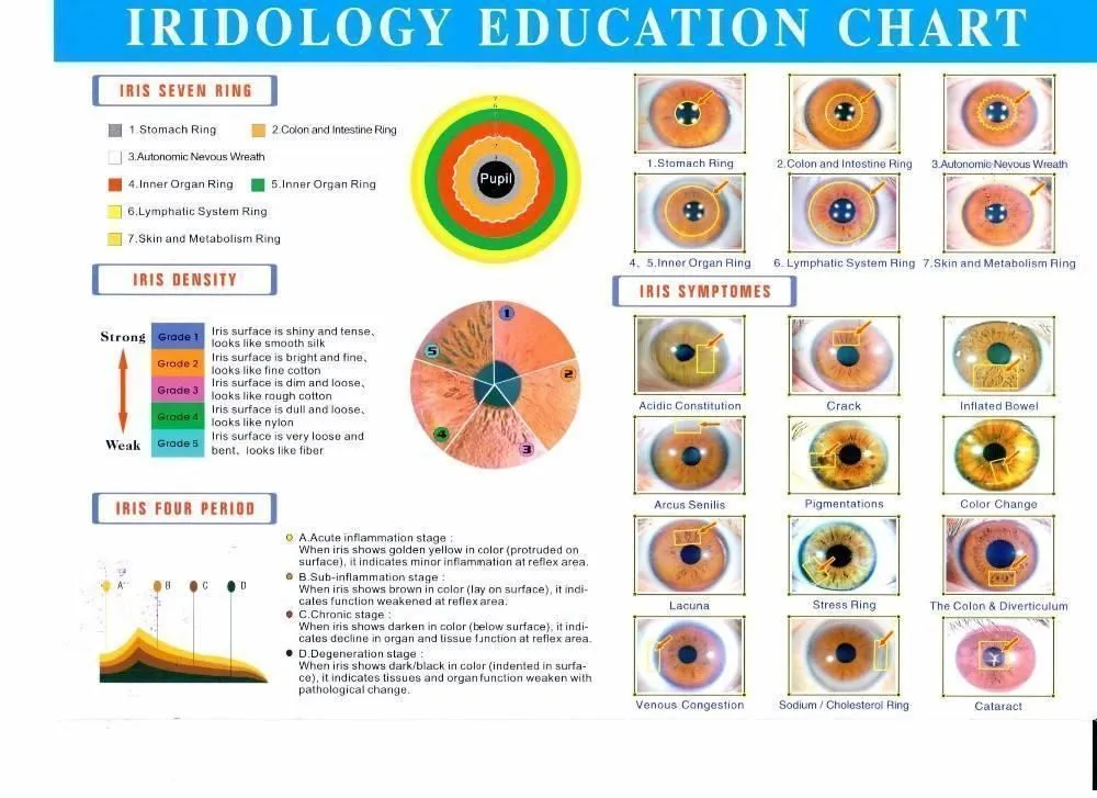 Update Iridology USB Iriscope Camera Latest Iris 12MP Professional Software