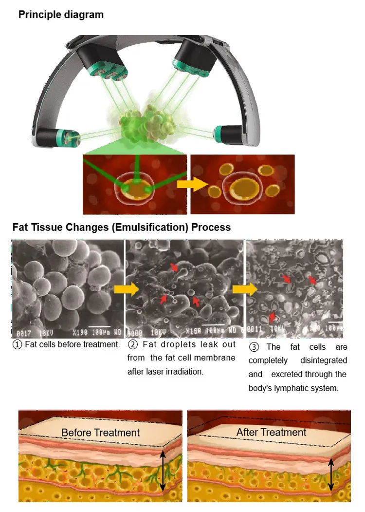 Non-invasive 10d Rotating Emerald Laser Fat Remover Body Slimming Machine 10 Heads Diode 532nm Green Light Laser Cellulite Removal Cold Laser Machine Non-invasive 10d cold laser fat remove machine green light - Honkay laser fat removal,lipo laser fat removal,laser lipo fat loss,lipo laser,lipo laser machine