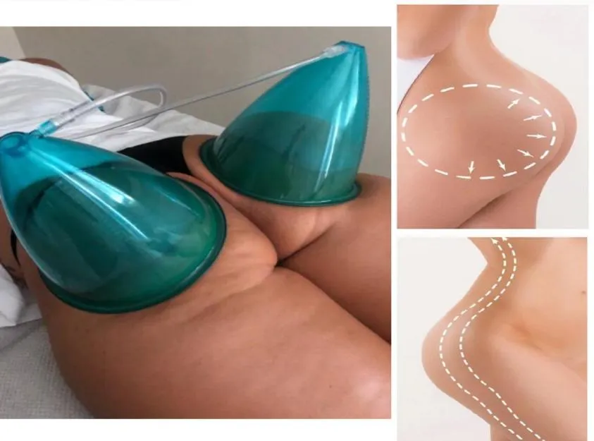 2Pcs 21cm King Size Vacuum Suction Blue XXL Cups With Vacuum Tube for Sexy European American Female Butt Breast Lifting1938745