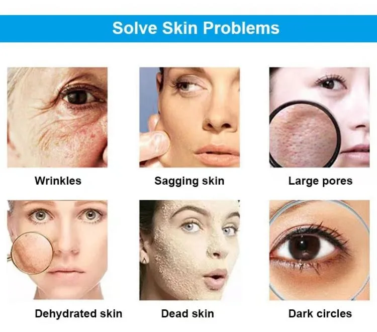 11-in-1 Portable Facial Machine - Home Use RF BIO Hydra Dermabrasion ...