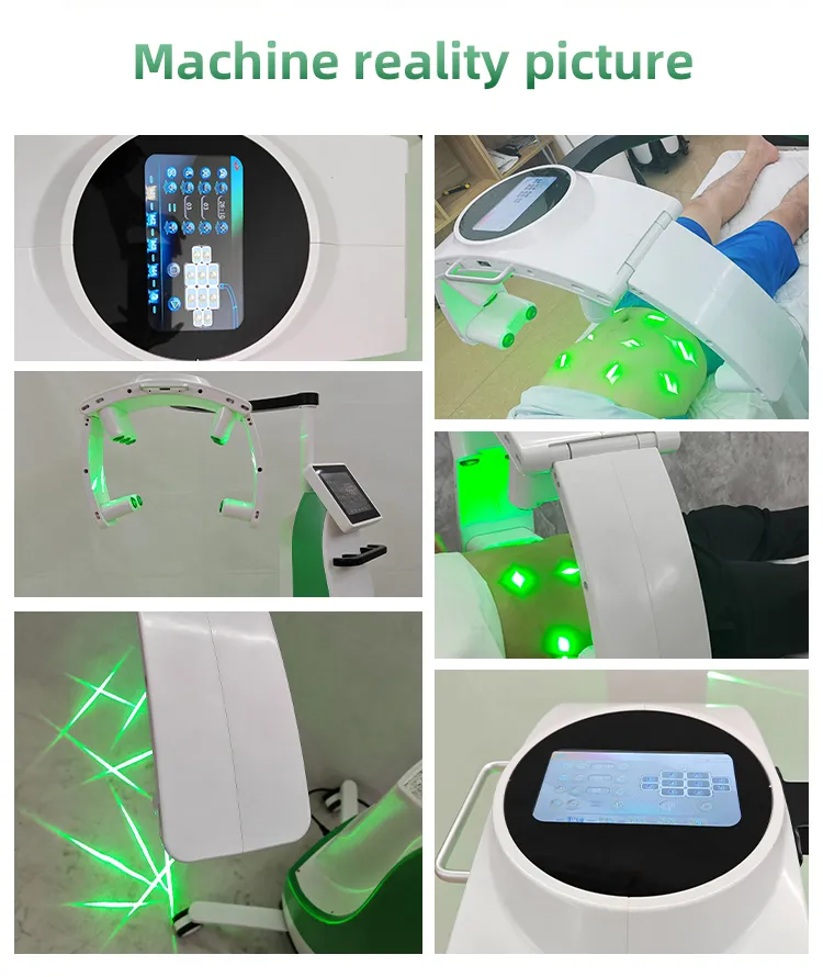 Non-invasive 10d Rotating Emerald Laser Fat Remover Body Slimming Machine 10 Heads Diode 532nm Green Light Laser Cellulite Removal Cold Laser Machine Non-invasive 10d cold laser fat remove machine green light - Honkay laser fat removal,lipo laser fat removal,laser lipo fat loss,lipo laser,lipo laser machine