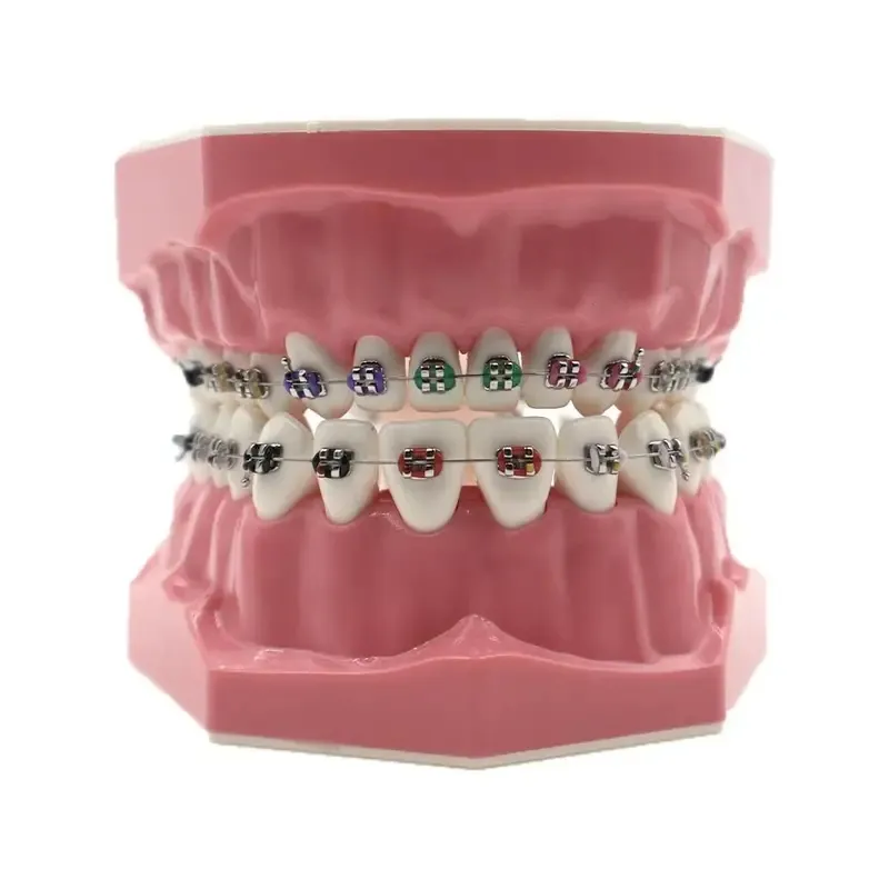 1 шт. стоматологическая ортодонтическая модель зубов с металлическими брекетами для исследования, демонстрация