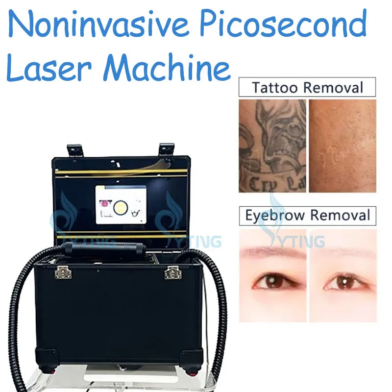 Pico andra q switch laser picosecond nd yag laser tatuering avlägsnande fräknad borttagning pigmentering behandling