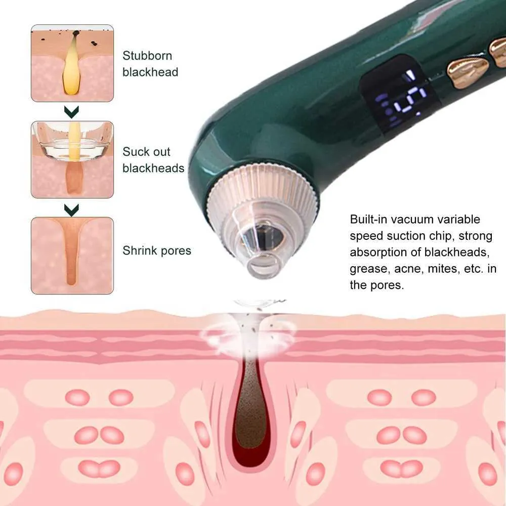Magnified Blackhead Extraction