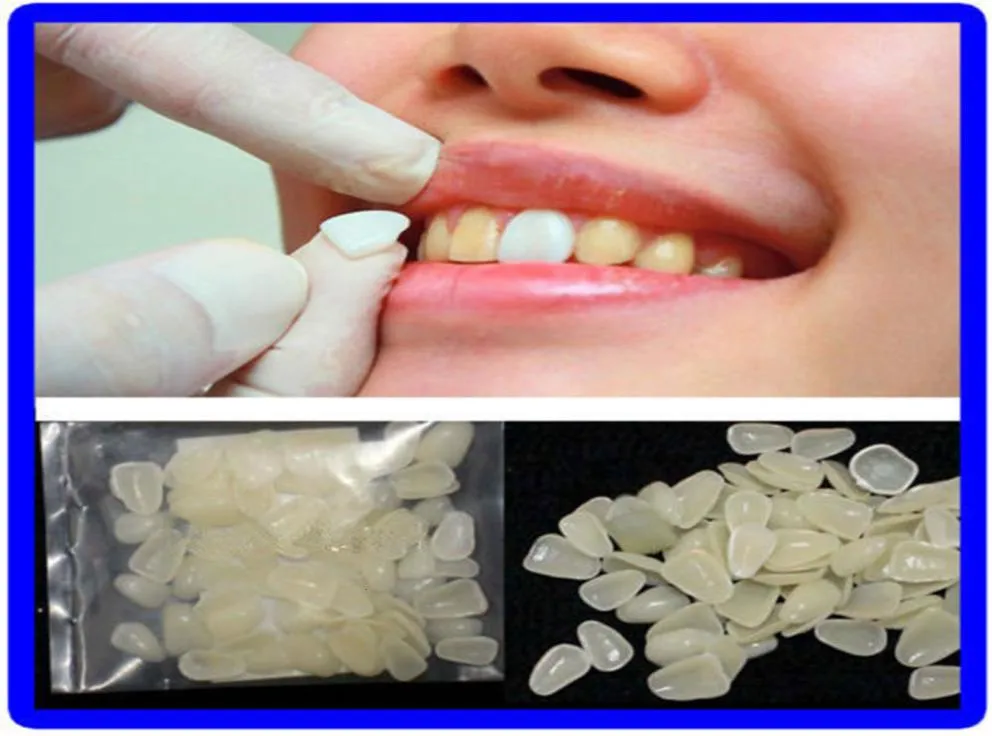 Autres articles d'hygiène bucco-dentaire 70pcs / lot Couronne dentaire temporaire ultra fine Résine ultra fine Blanchiment des dents Facettes dentaires supérieures antérieures 2873068