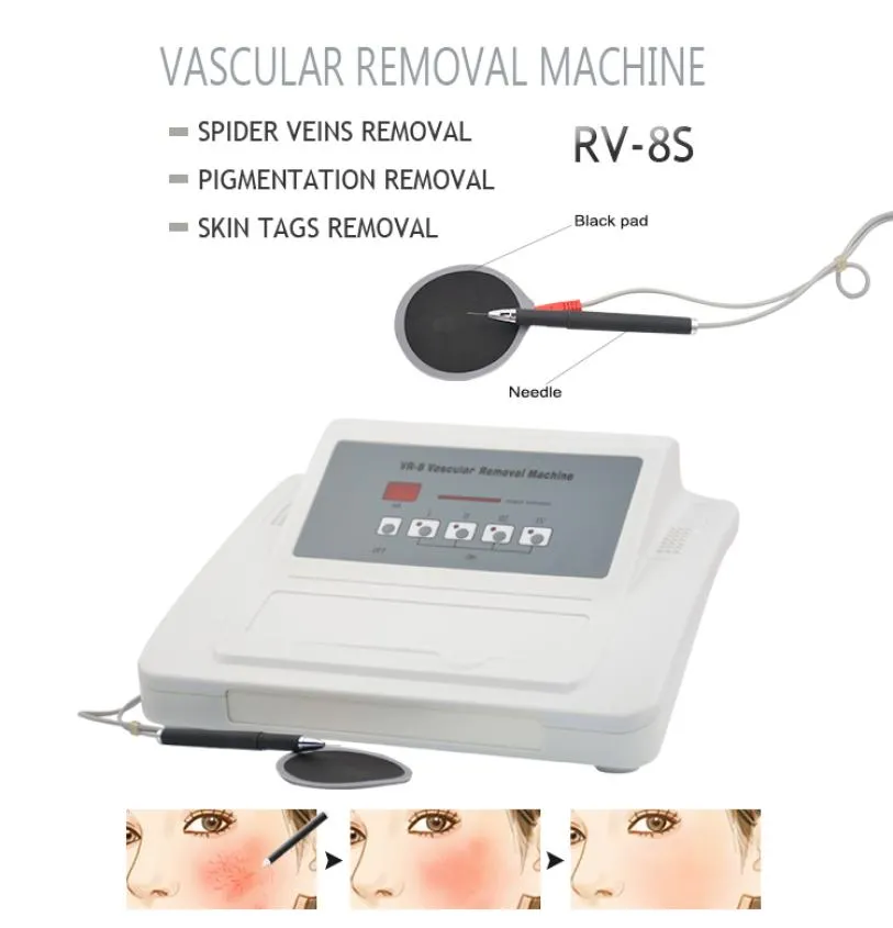 Artikelen Hoge frequentie spataderen verwijdering machine Rood bloed gezicht lichaam vasculaire behandeling verwijderen Roodheid apparaat1792437