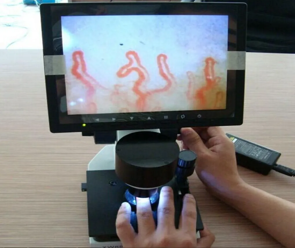 2016 New 8インチカラースクリーンヘルスアナライザーネイルフォールドキャピラリーマイクロサーキュレーション顕微鏡爪の血管アナライザー6939286