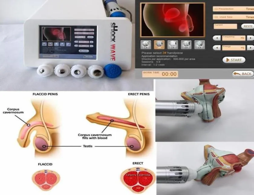 ESWT Shock wave Therapy Machine Electromagnetic Extracorporeal ShockWave Pain Treatment System and Erectile dysfunction treatment8015117