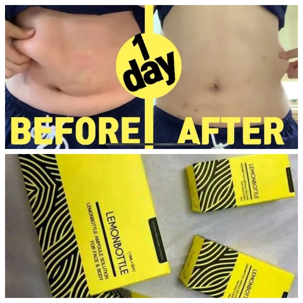 LEMON BOTTLE 5本セット professional lemon bottle set of 5 vials for weight management and