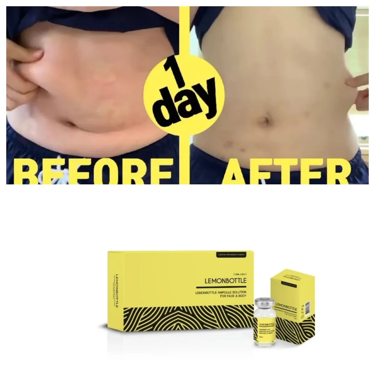 LEMON BOTTLE 5本セット professional lemon bottle set of 5 vials for weight management and