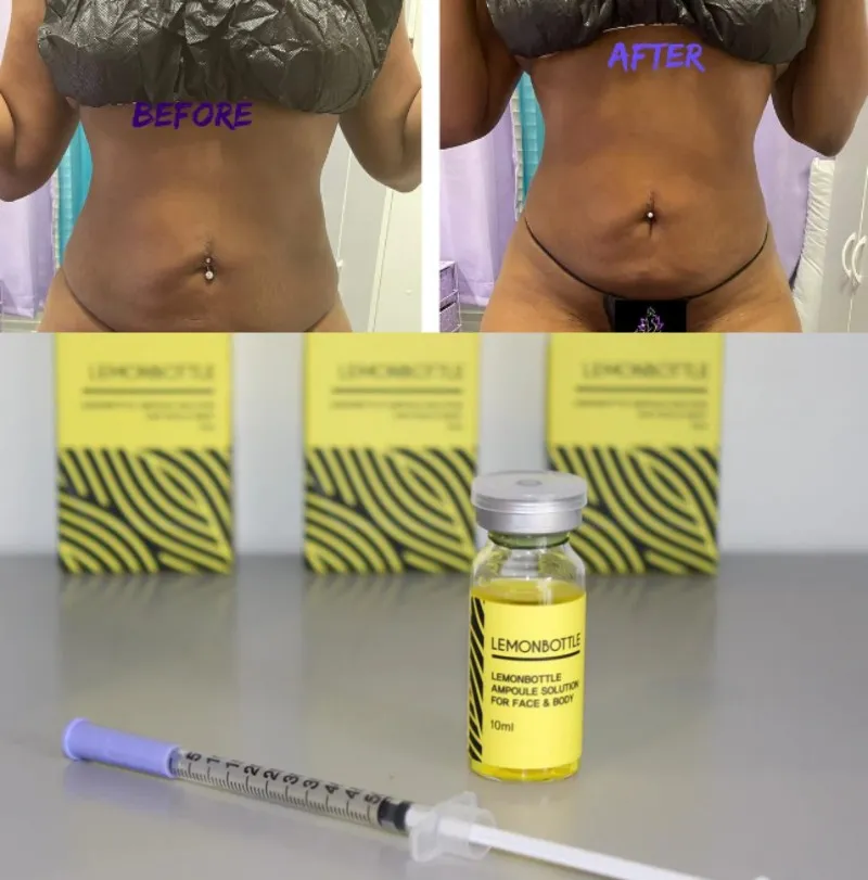 professional lemon bottle set of 5 vials for weight management and