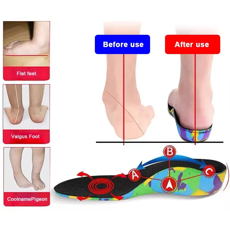 Insoles Flat Feet Mall Arch Support Orthopedic Insersoles, barn vuxna plantar fasciit häl smärta ortotik insula sneakers sko insats