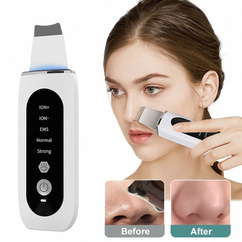 ultrasic Skin Scrubber Peeling Blackhead Remover Deep Face Cleaning Ultrasic I Ance Pore Cleaner Facial Shovel Cleanser p8BR#