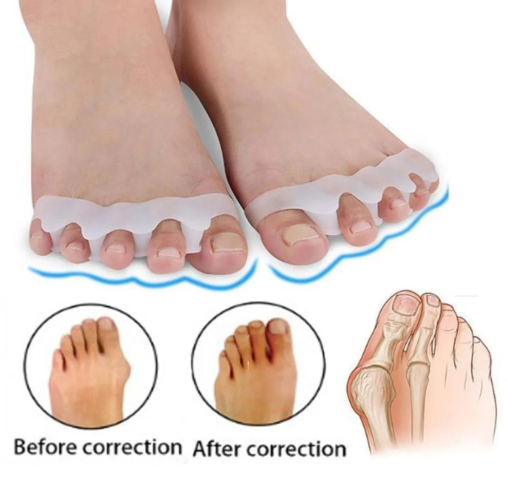 HALLUX VALGUS BRACES TOE SEPATEAROVE TOESリハビリテーション治療フットボーンオリティックデバイスフィートケアシリコンゲルBUNI8683904