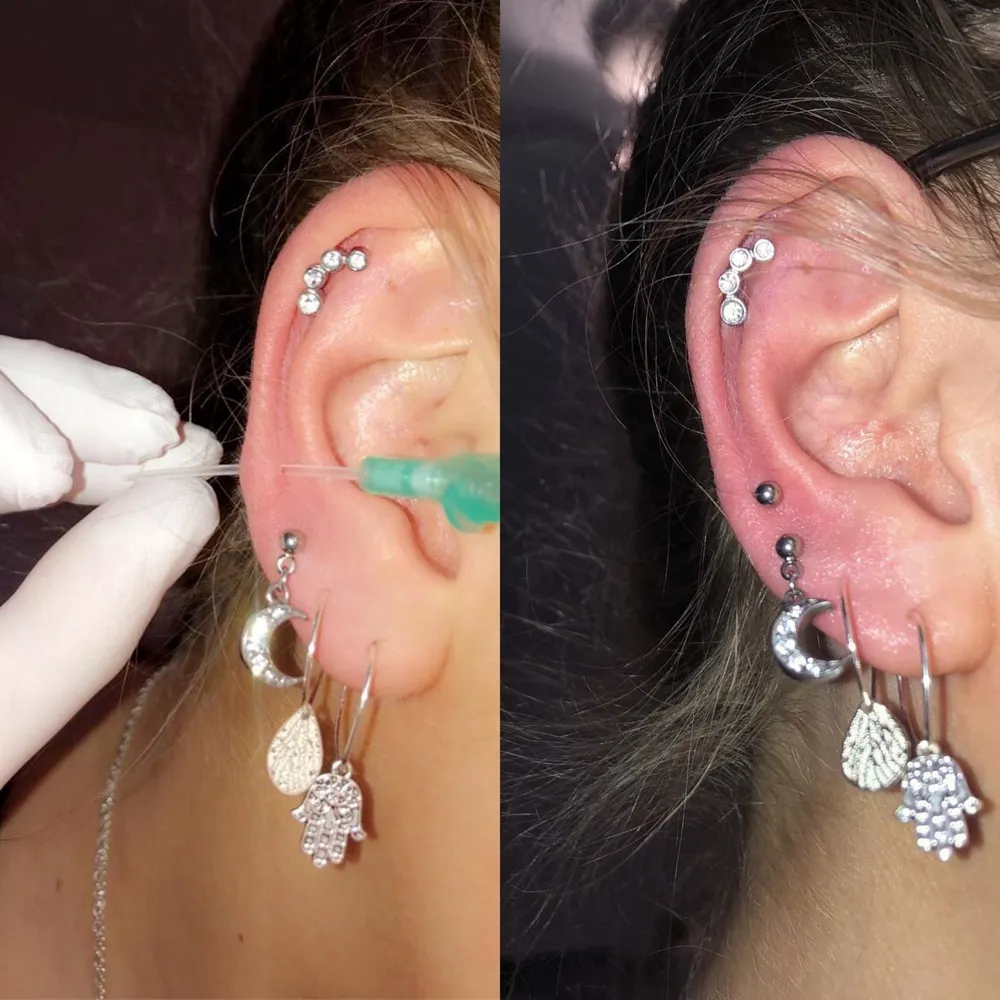 Cartilage Piercing Ear Piercing Needle Gauge Lobe Piercings Gauge