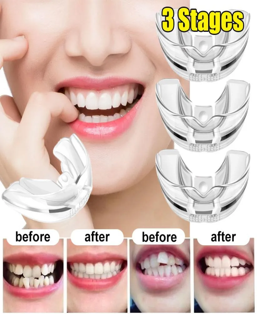 1PC Orthodontic Braces Appliance Dental Braces Silicone Alignement Trainers Dentrages Bruxism Dents de protège-dents Bruxisme 3439332