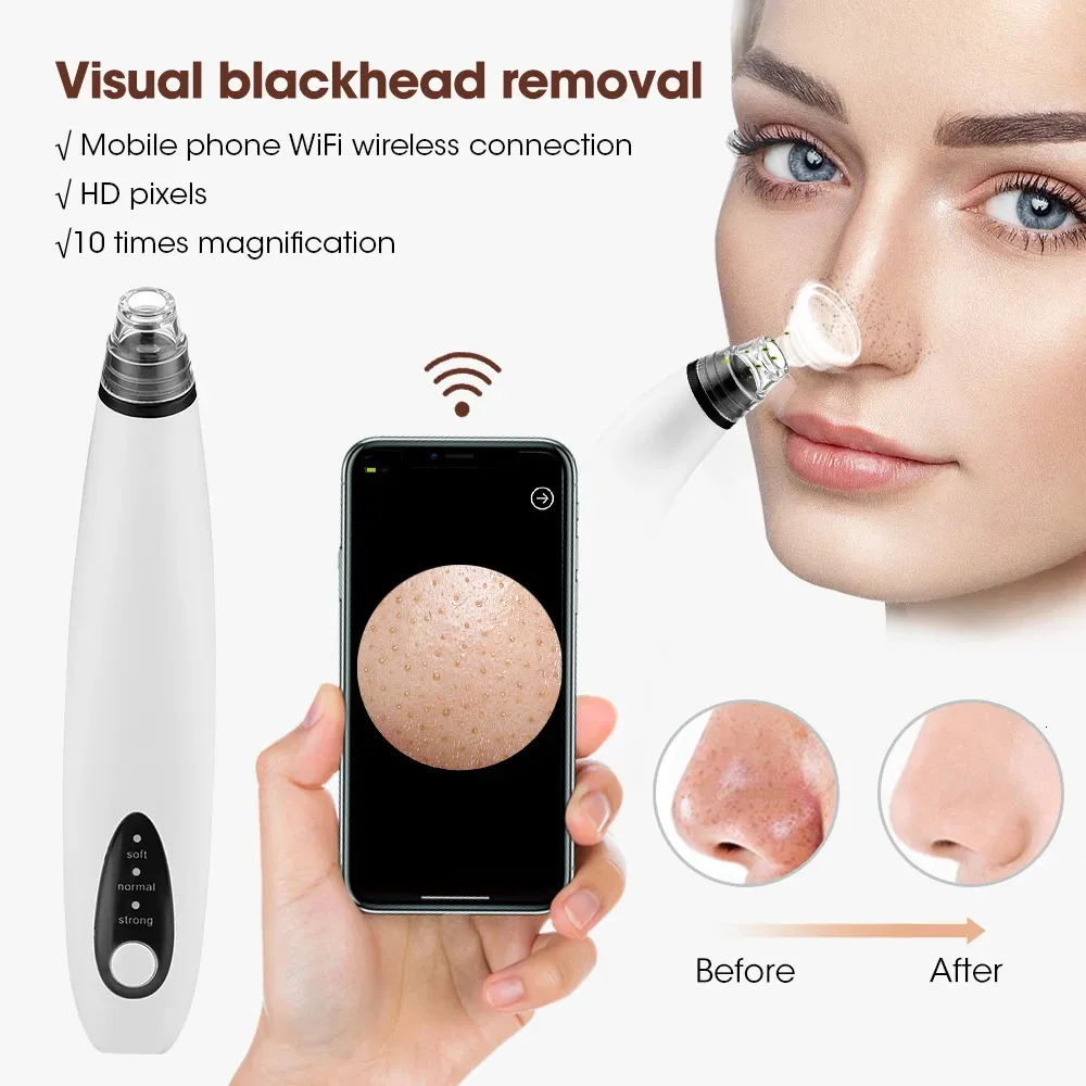 Visual Electric Blackhead Remover 3 niveaux d'aspiration vide acné pore nettoyeur noir noirs ctor nettoyage en profondeur soins de la peau 240422