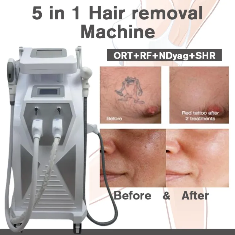 Épilation des cheveux IPL Machine FDA 4 en 1 Medical Allemagne E-Light Alight