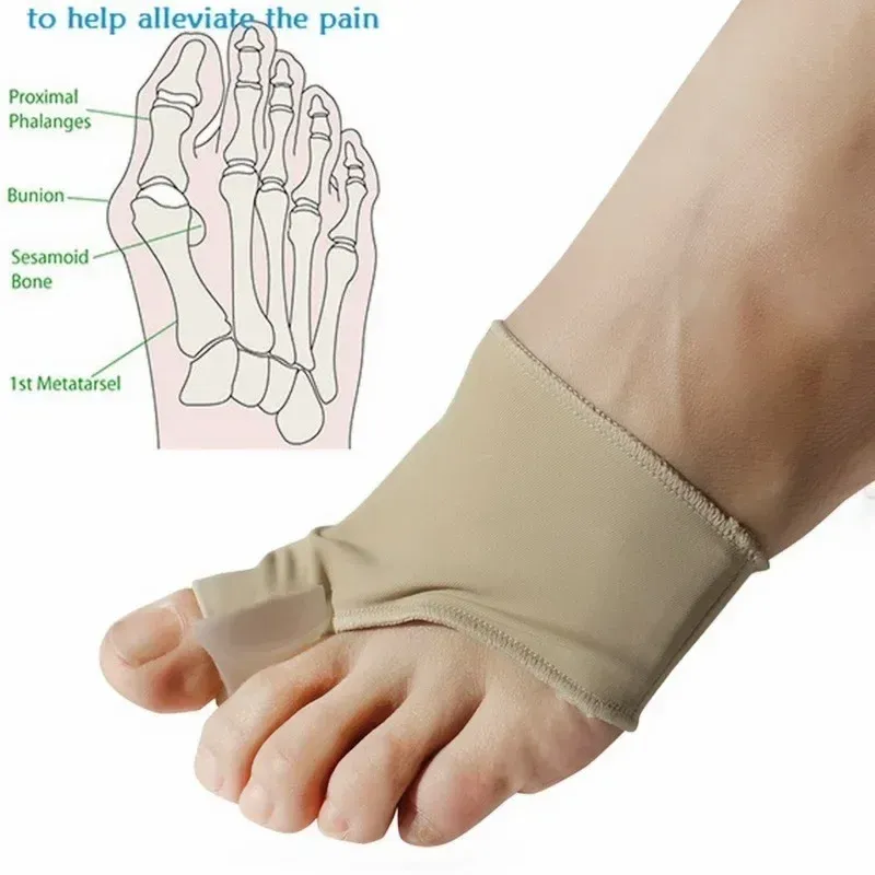 = dedo dedo do pé de dedo do pé alux valgus bunion corretor ortons pés pés ósseo polegar correção de correção de pedicure alisador de meia