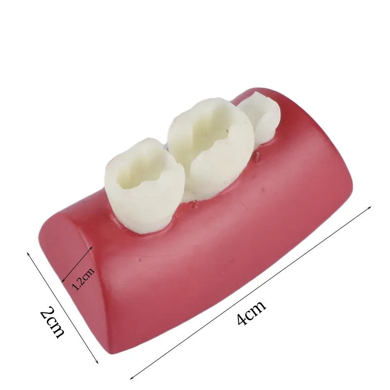 Exercise Blocks For Dental Inlay Practice Anatomical Teeth Models With ...