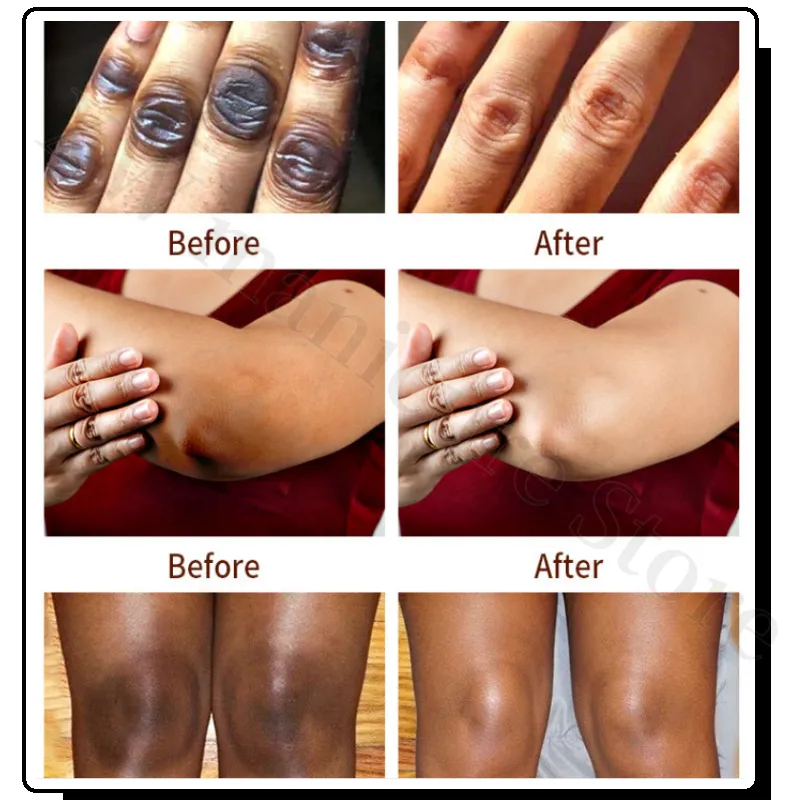 glutathione soap before and after 100g Kojic Acid Glutathione Soap Handmade Brightening Skin Color Reducing  Melanin Exfoliating Body Whitening Moisturizing Soap from Dhgate Other Arts  and Crafts