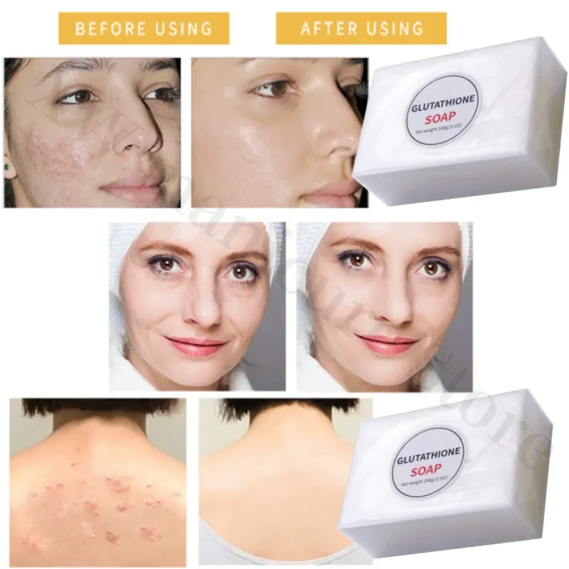 100g Kojic Acid Glutathione Soap Handmade Brightening Skin Color Reducing  Melanin Exfoliating Body Whitening Moisturizing Soap from Dhgate Other Arts  and Crafts