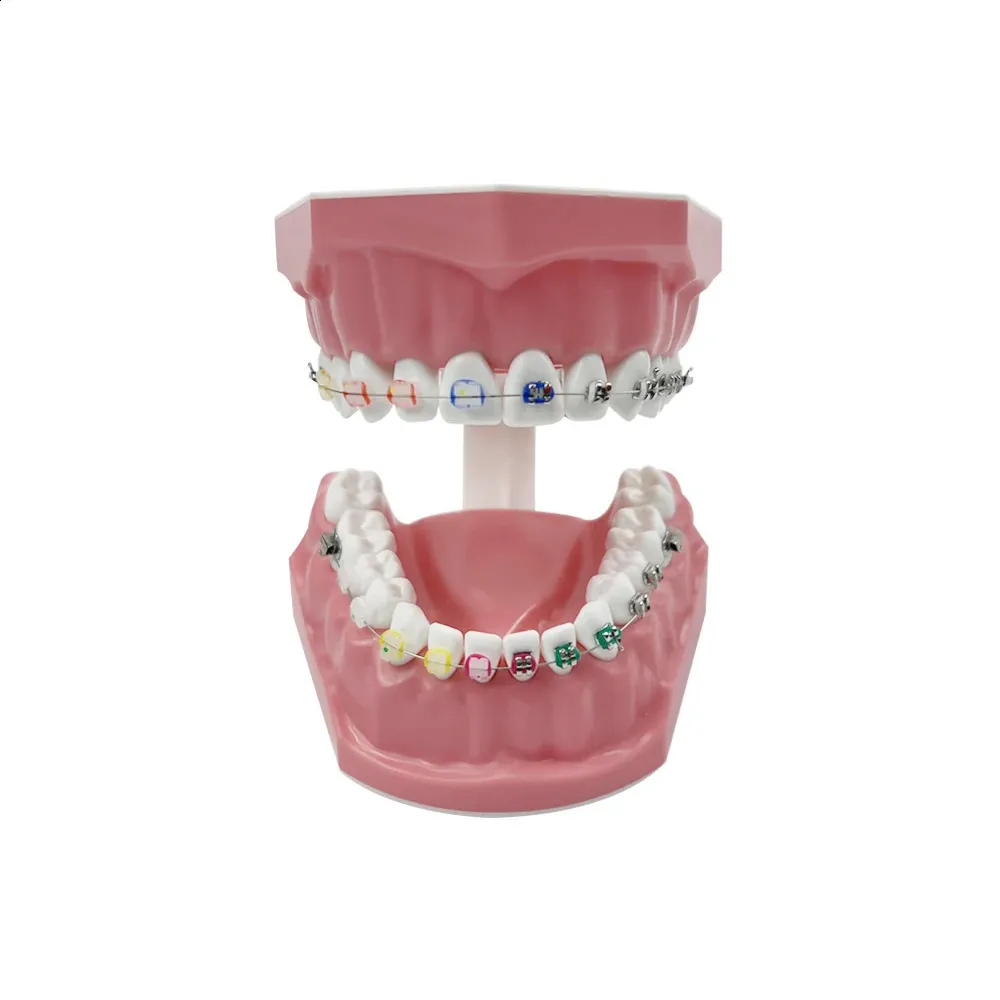 Dental Model Orthodontic Teeth Model With Half Metal & Ceramic Brackets ...