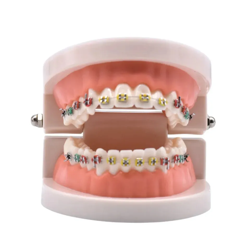 Dental Orthodontic Teaching Model - Teeth with Brackets, Arch Wire ...