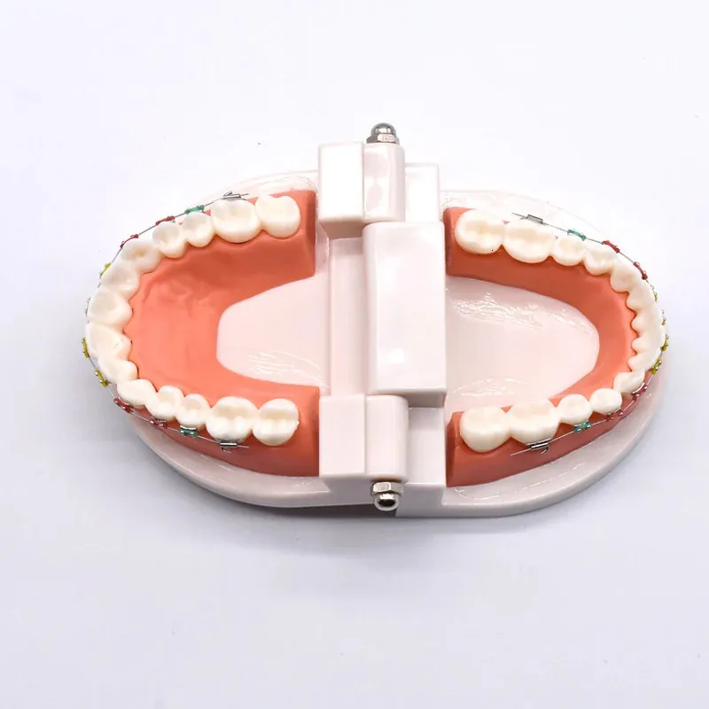 Dental Orthodontic Teaching Model - Teeth with Brackets, Arch Wire ...