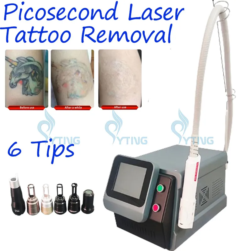 6 punte Picosecondi Picosecondo Rimozione del tatuaggio del corpo Laser Rimozione Pigmentazione Pigmentazione Frentù rimozione