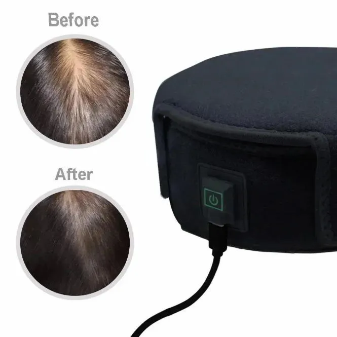 Portable Led Light Therapy Anti Aging Red Light Therapy Cap Home Use ...