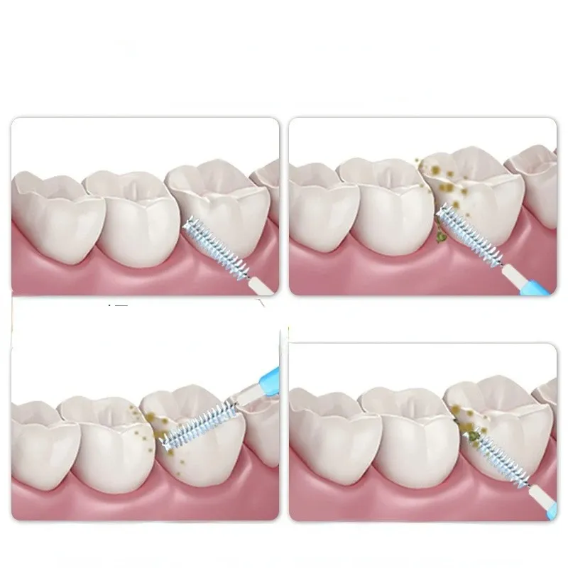 치아 칫솔 청소 구강 도구 치과 치아 치아 교정 휴대용 0.6-1.2mm Portable 치아 치열 교정 도구