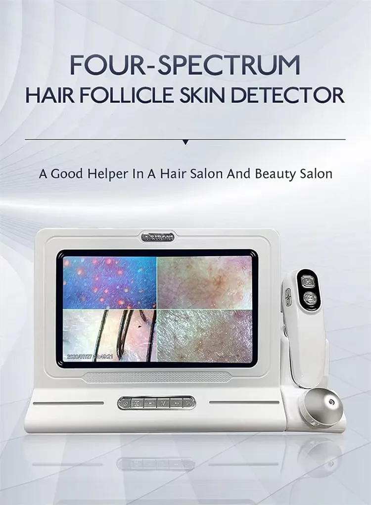 High Quality HD 3D Portable Scalp Scanner Detector: 3D Hair Analyzer ...