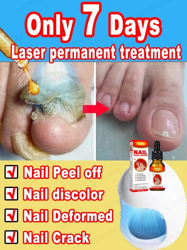 Traitements Fungal Nail Laser Dispositif Réparation des ongles rapides Champignons onychomycose