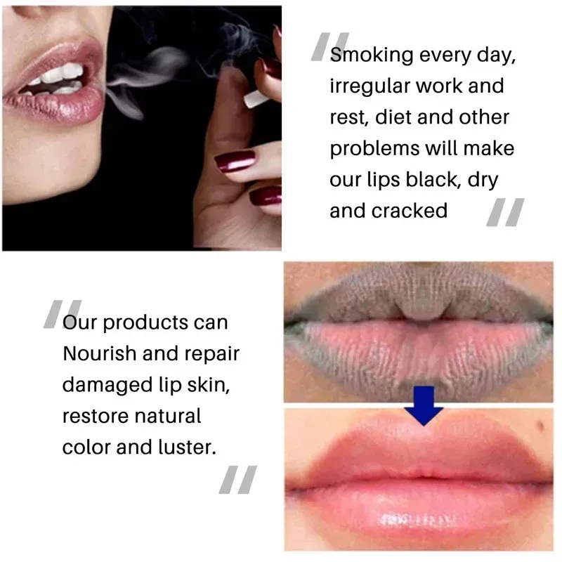 Remove Dark Smoke Lip Balm Lightening Melanin Bleaching Gloss Oil Lips Pink  Lipstick Exfoliating Fade Lip Lines Korean Cosmetics Full Size from Dhgate  Other Office & School Supplies