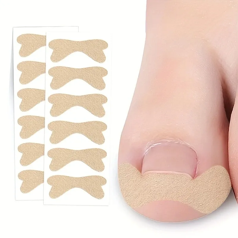 La patch di unghie dei piedi senza colla migliora la riparazione incarnita dell'unghia del piede e allevia la correzione della piega delle unghie