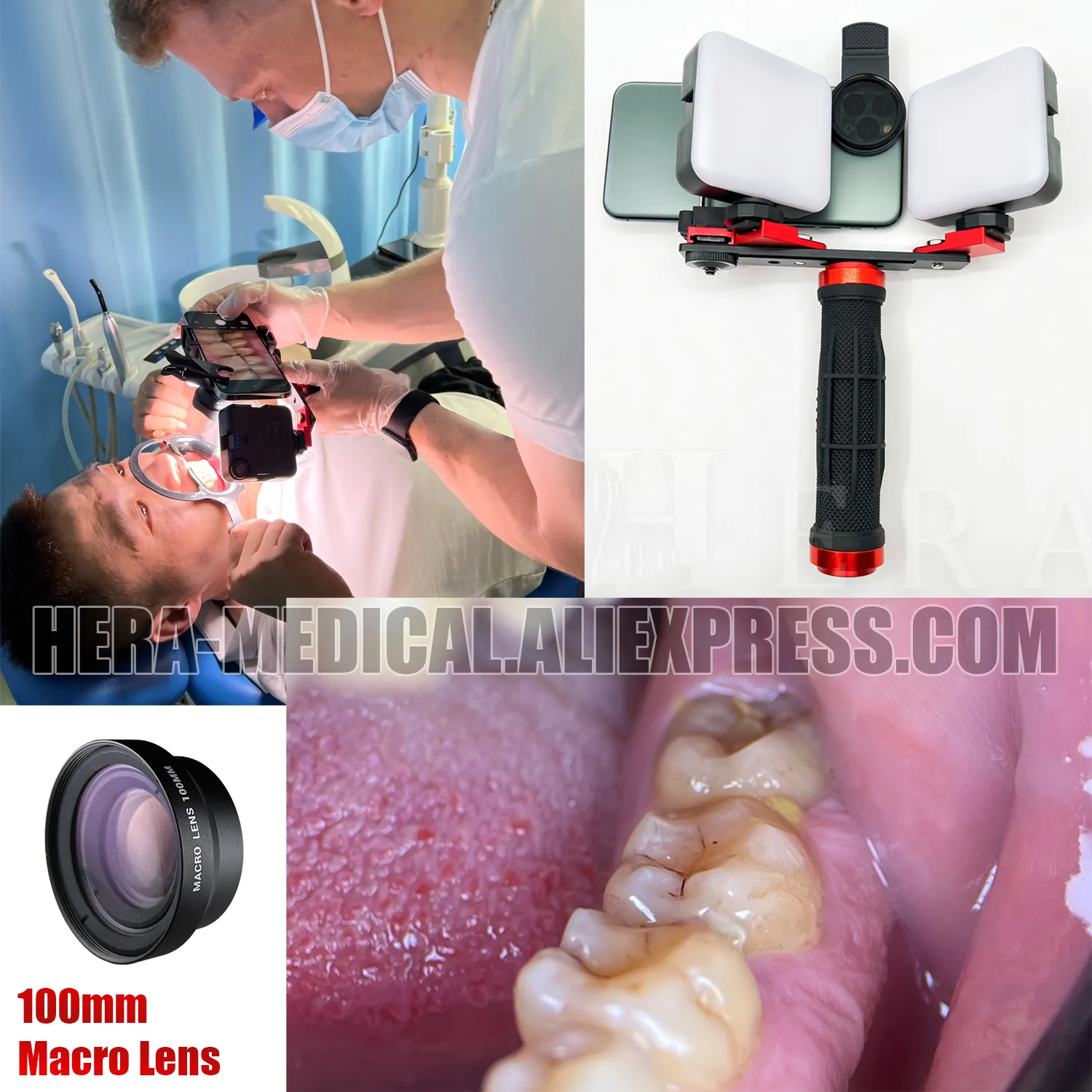 Dental Obile Phone Photography Fill Light LED Oral Filling Lap Treatent Colorietric Photo Video Flashlight For Dentistry - Triple Handles LED Lap, Obile Photograhy Fill Light