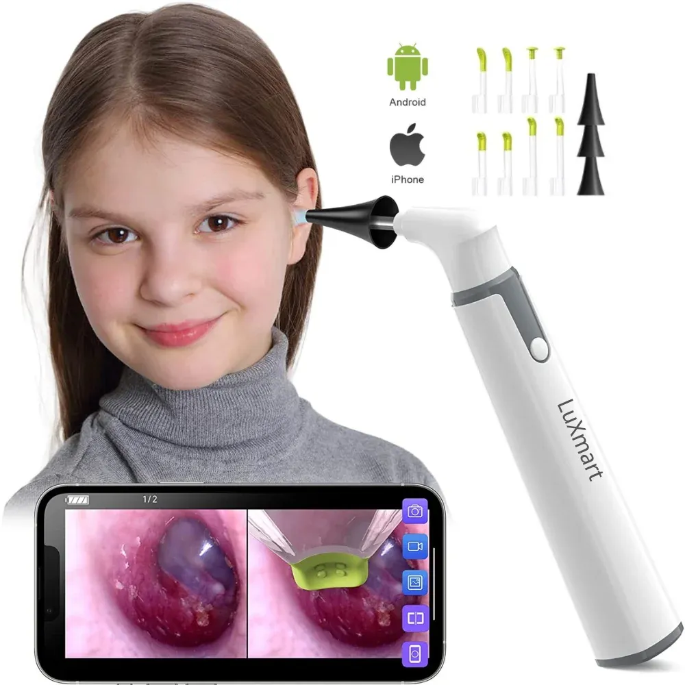 Endoscopio per fotocamera a orecchie di lente 3,9 mm Otoscopio wireless 720p HD WiFi EAR con 6 LED per bambini e adulti supportano Android e iPhone