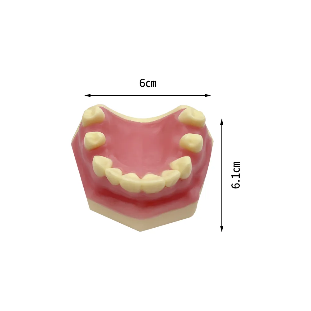 Dental Implant Teeth Model Practice Demo Typodont For Dentist Student Studying Teaching Models Dentistry Laboratory Products