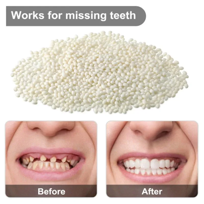 Resin10g / 15g / 20g Kit de réparation de dents temporaire Kit de dents et lacunes falseureth la colle solide prothèse adhésive de dents de blanchiment