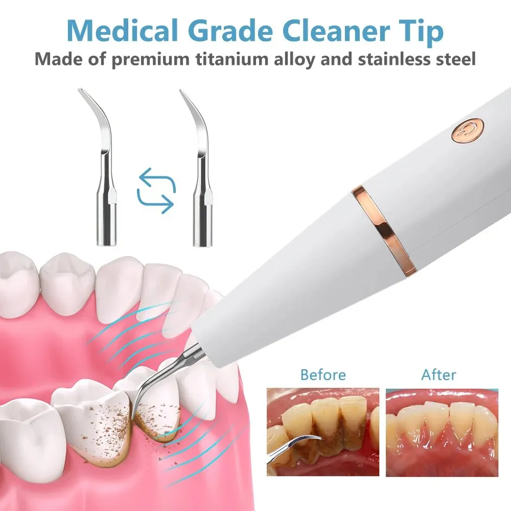 Dental calculus remover discount