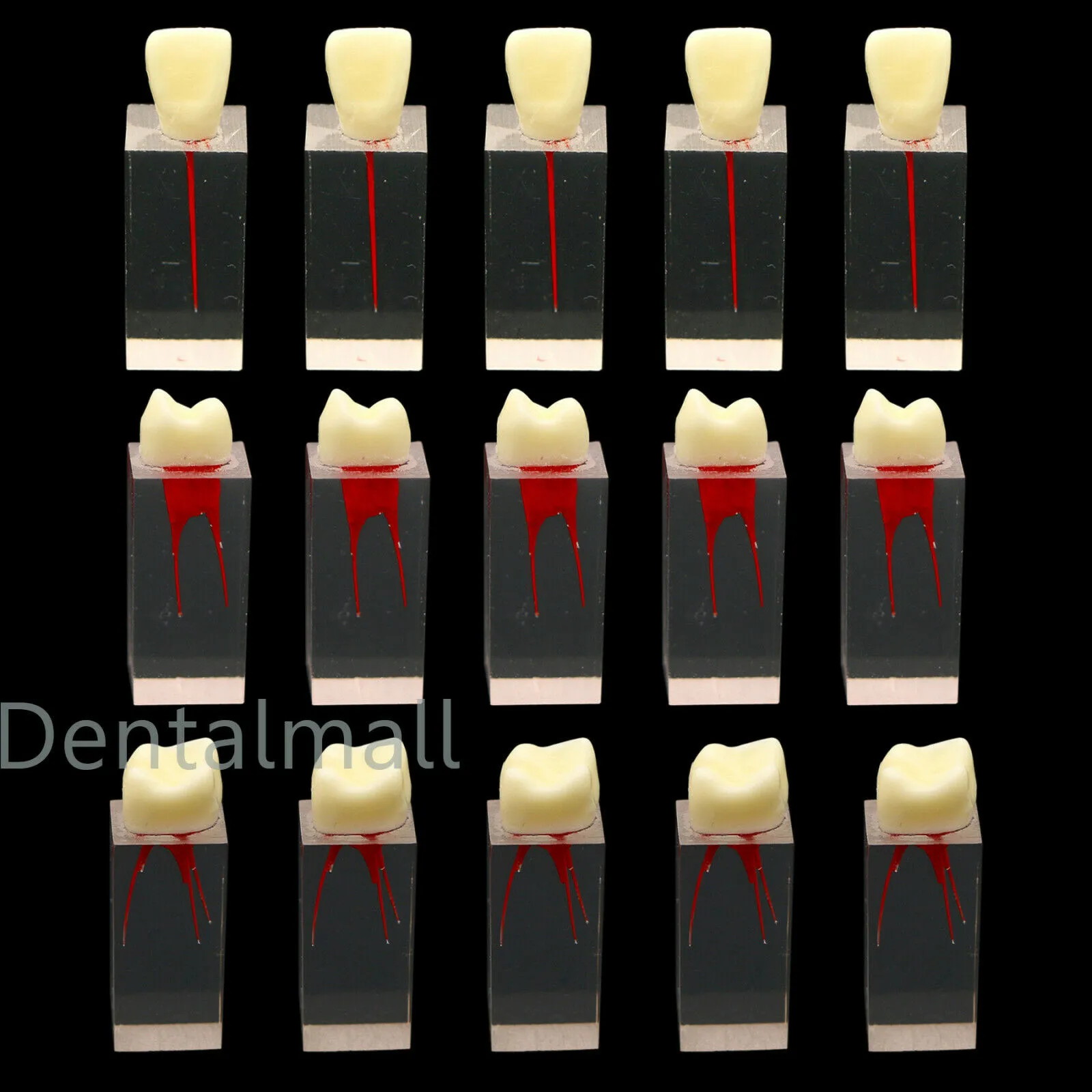 5pcs Dental Root Teeth Teeth Molar Model Practice Practice pour le fichier de pâte endodontique