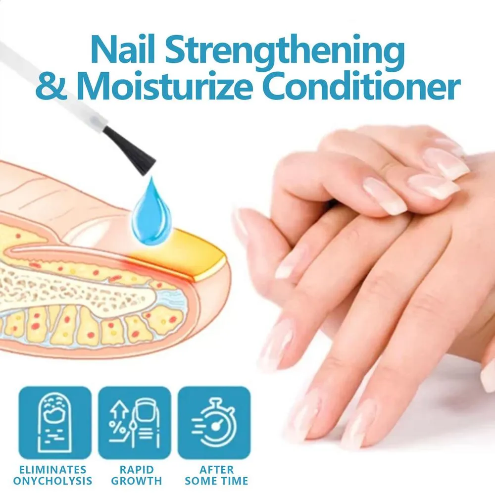 Nail Strengthening Cuticle Oil Moisturizing Nails Oil For Soft Peeling ...