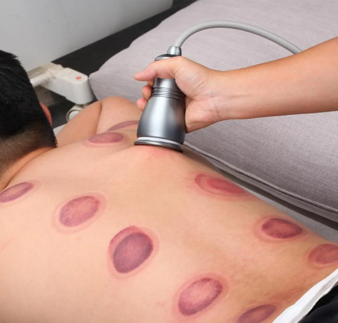 Fysiotherapie Gadgets Cupping Meridian Dedge Massage Body Cups Zuigpotten Spier Relax Electric Gua Sha Machine Vacuüm Back SCR3806620