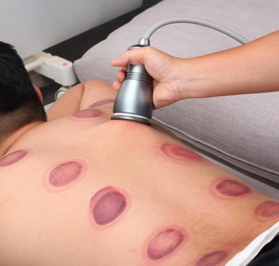 Gadgets de physiothérapie cupping des tasses de massage de dragage méridien méridien pots d'aspiration muscle relax électrique gua sha machine vide dos record 3806620