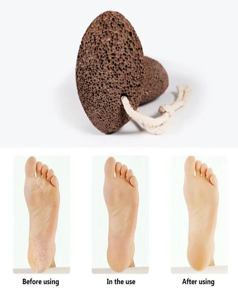 Removedor de calos de pele dura Ferramenta de pedra -pomes de lava natural Pumice Stone Callus Removedor de café para PETE PEDICURE Ferramenta de esfoliação6033981