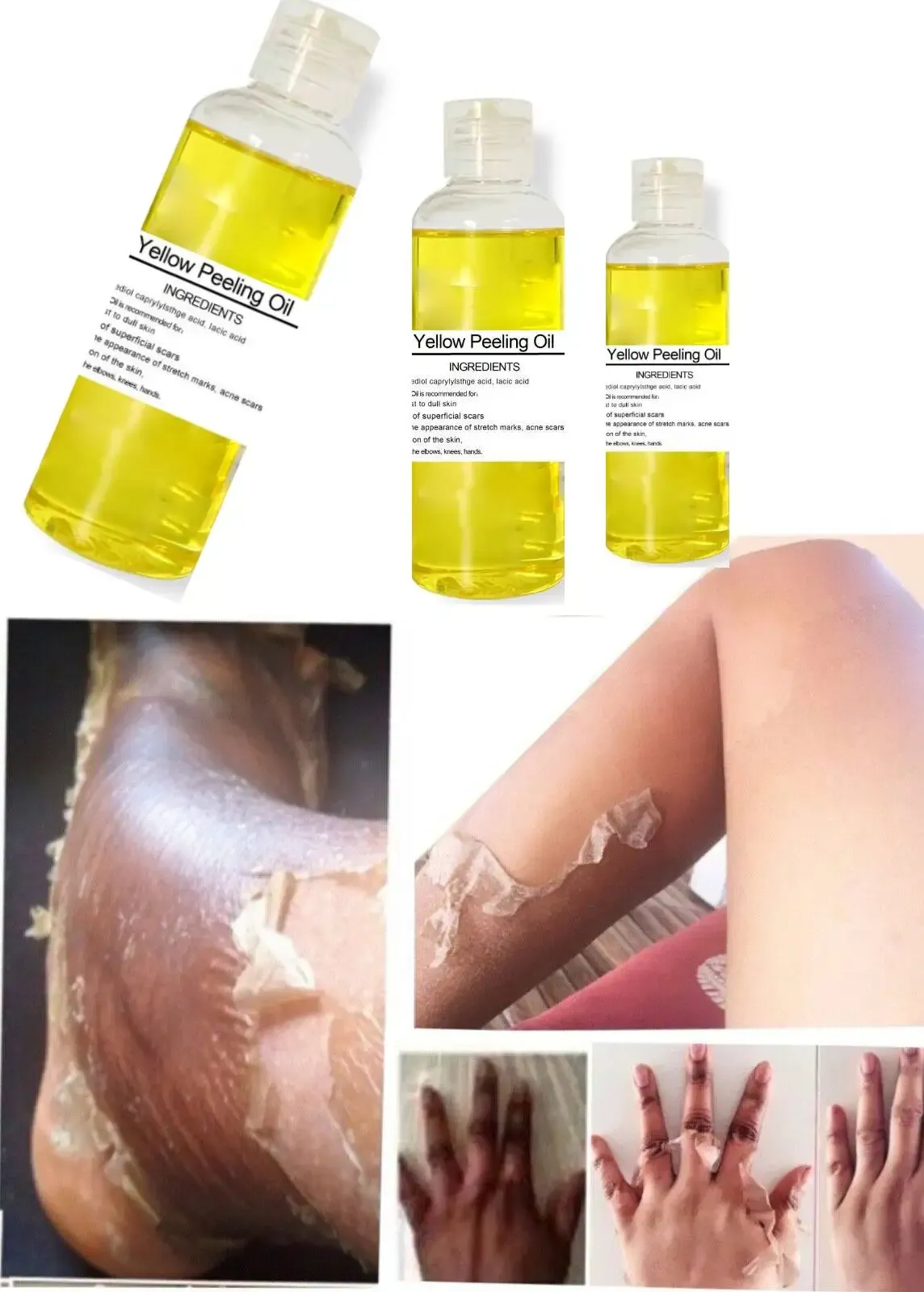 Toners Yellow Peeling Oil Extra Strength Rough Tough Skin Lightening Rejuvenating 30ml Strength Yellow Oil Peeling