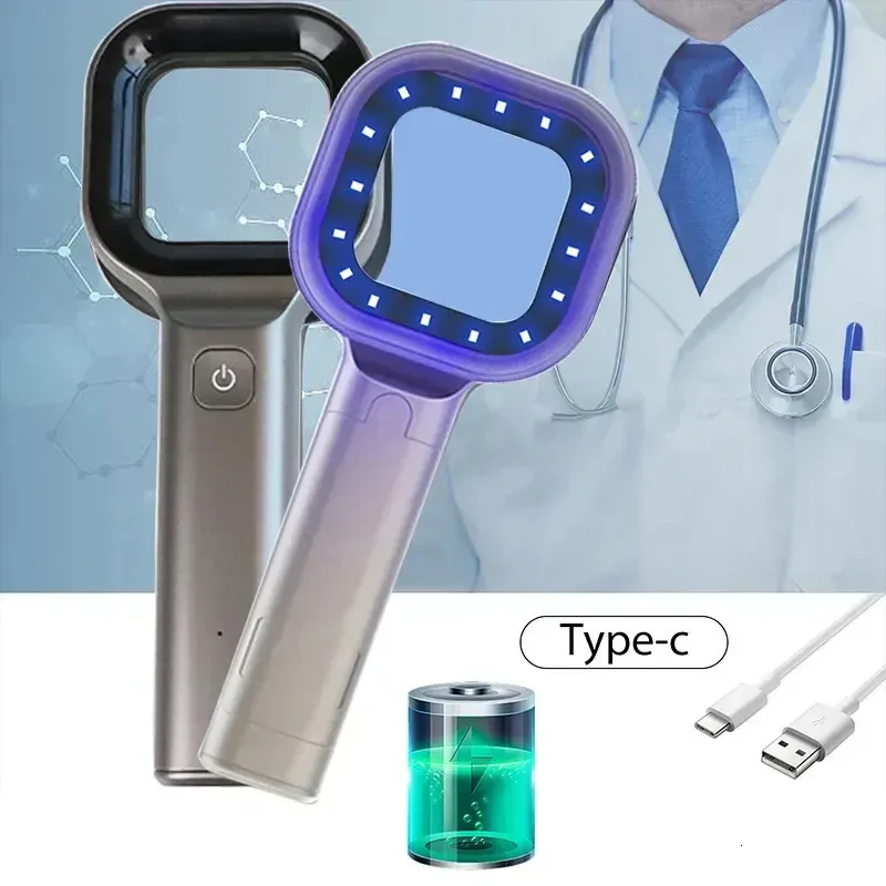 Waldlampe für Hautanalysatormaschine Ultraviolette Lampe UV Hautuntersuchung Schönheitstest Vergrößerung Analyse Vitiligo Lampe 240418
