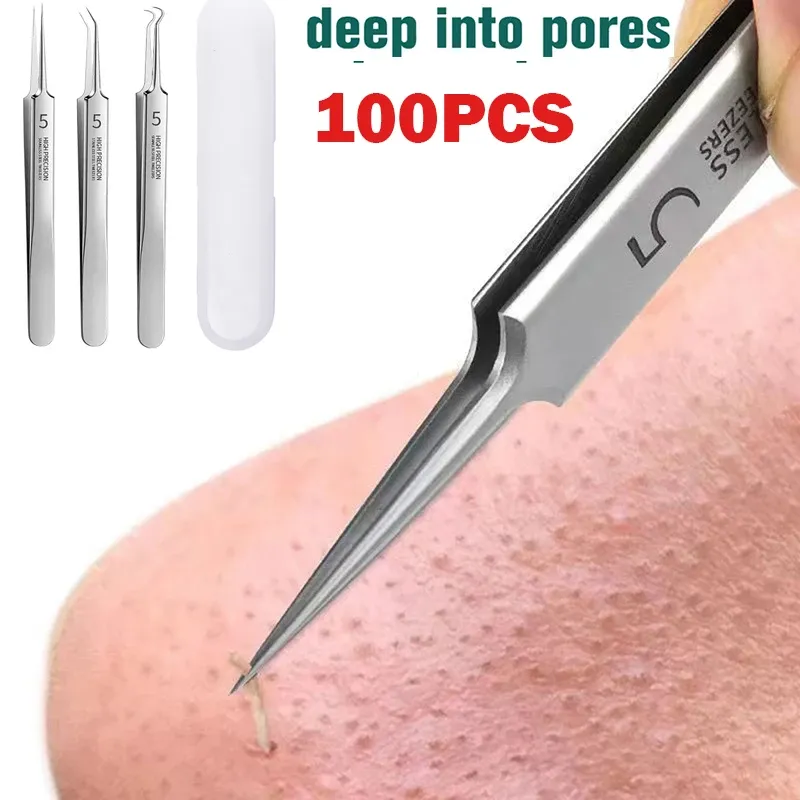 Instrument 100pcs acné de retrait de point noir